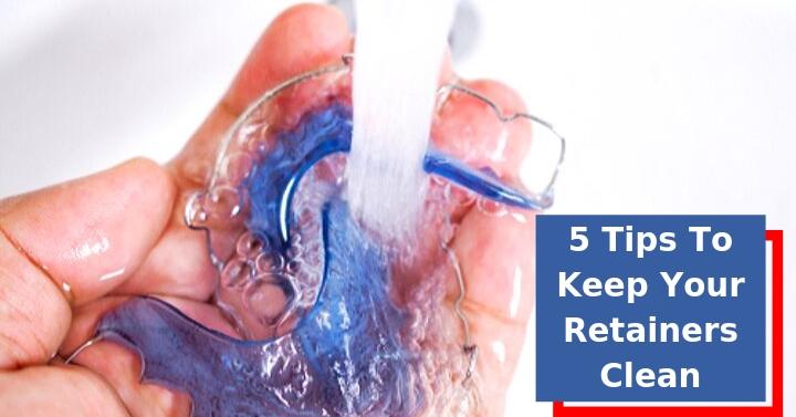 5 Tips To Keep Your Retainers Clean