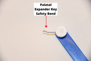 palatal expander key safety bend