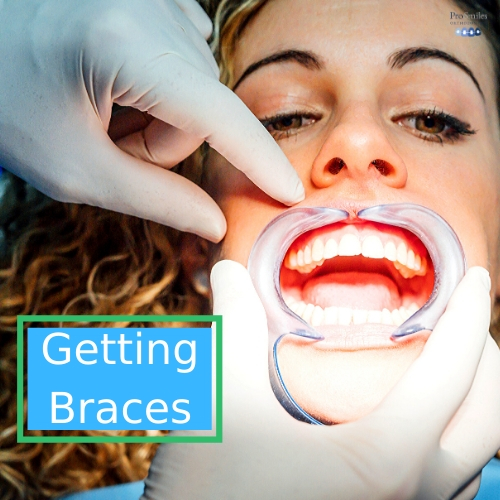 10 Questions To Ask Before Getting Braces